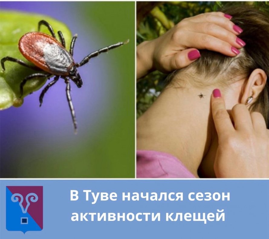 В Туве начался сезон активности клещей